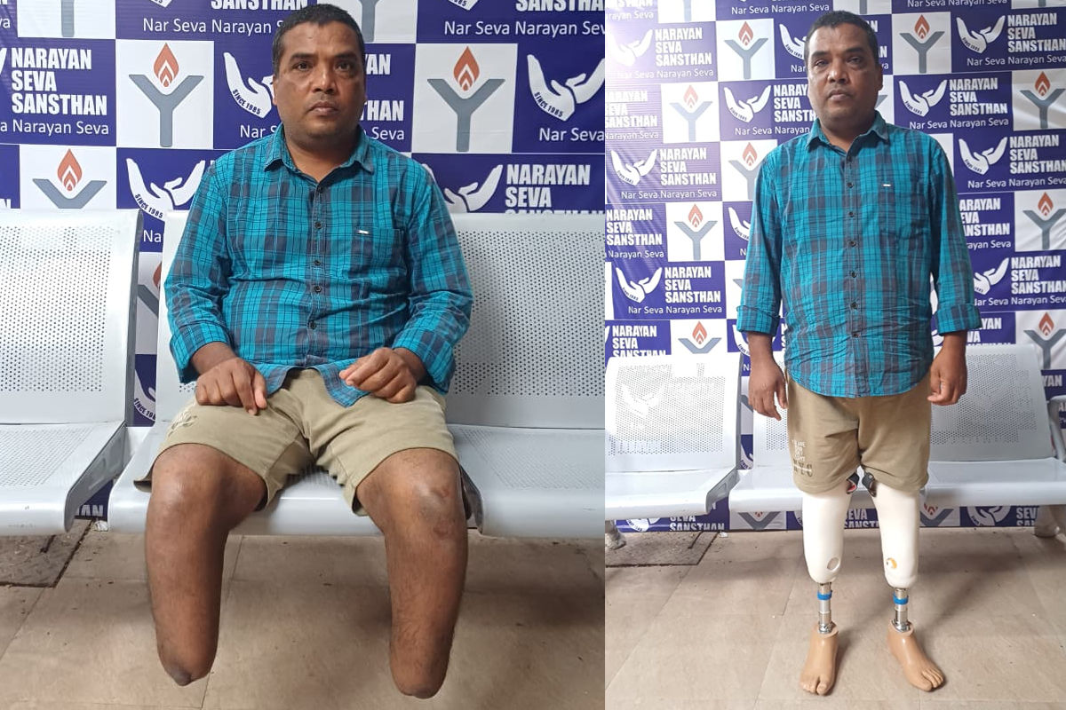 Artificial Limbs Distribution - Restoring Mobility, Rebuilding Lives