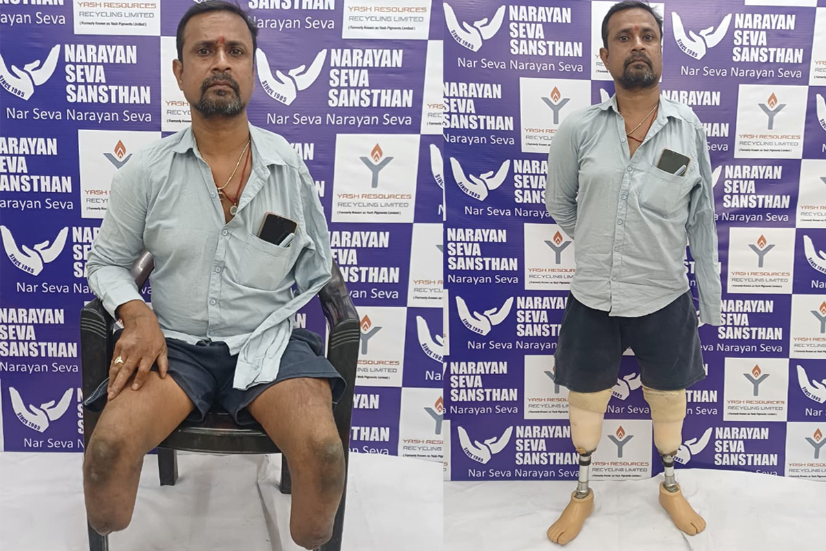 Artificial Limbs Distribution - Restoring Mobility, Rebuilding Lives